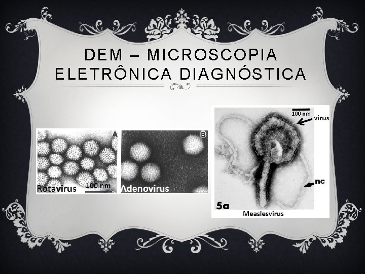 DEM – MICROSCOPIA ELETRÔNICA DIAGNÓSTICA 