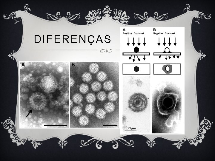 DIFERENÇAS 