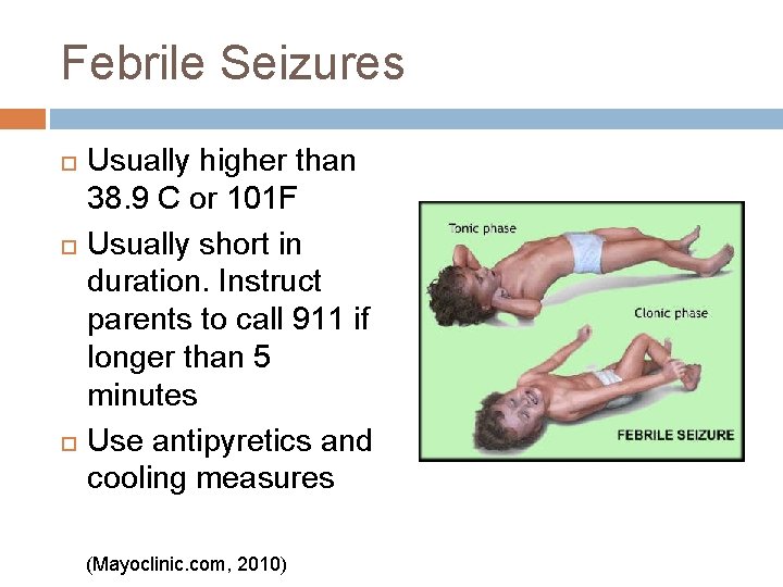 Febrile Seizures Usually higher than 38. 9 C or 101 F Usually short in Febrile Seizures Usually higher than 38. 9 C or 101 F Usually short in
