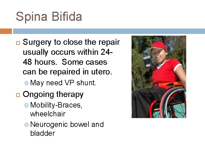 Spina Bifida Surgery to close the repair usually occurs within 2448 hours. Some cases Spina Bifida Surgery to close the repair usually occurs within 2448 hours. Some cases