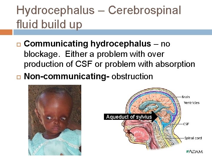 Hydrocephalus – Cerebrospinal fluid build up Communicating hydrocephalus – no blockage. Either a problem Hydrocephalus – Cerebrospinal fluid build up Communicating hydrocephalus – no blockage. Either a problem