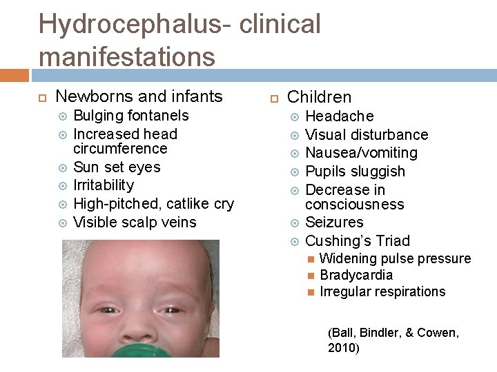 Hydrocephalus- clinical manifestations Newborns and infants Bulging fontanels Increased head circumference Sun set eyes Hydrocephalus- clinical manifestations Newborns and infants Bulging fontanels Increased head circumference Sun set eyes