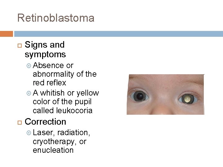 Retinoblastoma Signs and symptoms Absence or abnormality of the red reflex A whitish or Retinoblastoma Signs and symptoms Absence or abnormality of the red reflex A whitish or