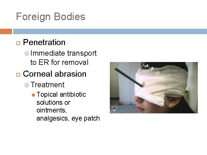 Foreign Bodies Penetration Immediate transport to ER for removal Corneal abrasion Treatment Topical antibiotic Foreign Bodies Penetration Immediate transport to ER for removal Corneal abrasion Treatment Topical antibiotic