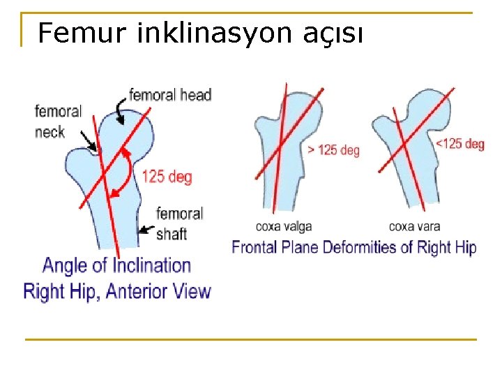 Femur inklinasyon açısı Femur inklinasyon açısı