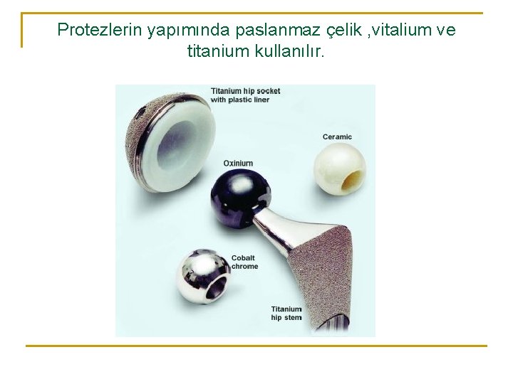 Protezlerin yapımında paslanmaz çelik , vitalium ve titanium kullanılır. Protezlerin yapımında paslanmaz çelik , vitalium ve titanium kullanılır.