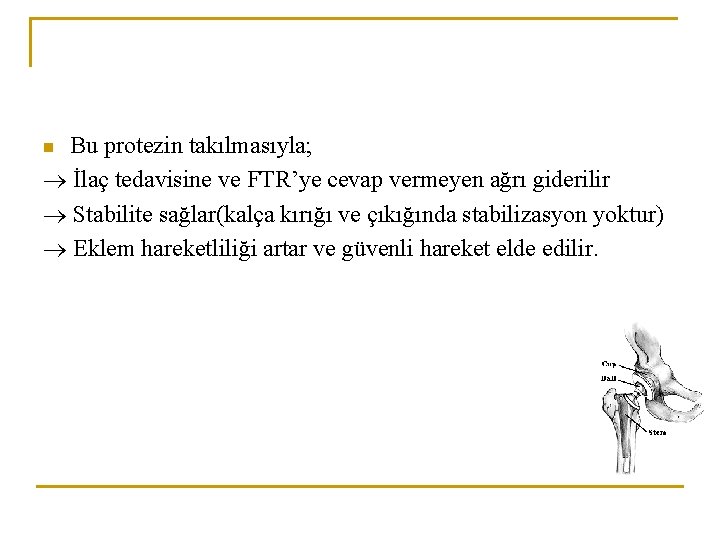 Bu protezin takılmasıyla; İlaç tedavisine ve FTR’ye cevap vermeyen ağrı giderilir Stabilite sağlar(kalça kırığı Bu protezin takılmasıyla; İlaç tedavisine ve FTR’ye cevap vermeyen ağrı giderilir Stabilite sağlar(kalça kırığı