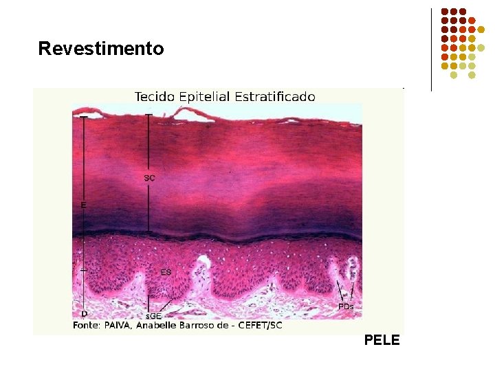 Revestimento PELE 