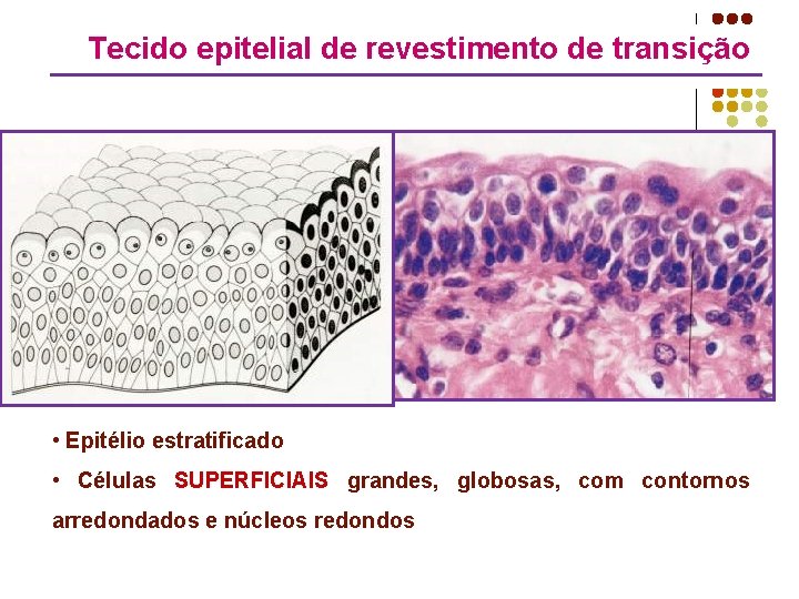 Tecido epitelial de revestimento de transição • Epitélio estratificado • Células SUPERFICIAIS grandes, globosas,