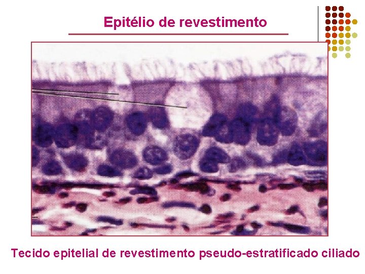 Epitélio de revestimento Tecido epitelial de revestimento pseudo-estratificado ciliado 