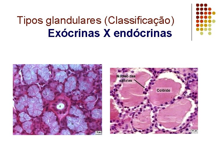 Tipos glandulares (Classificação) Exócrinas X endócrinas 