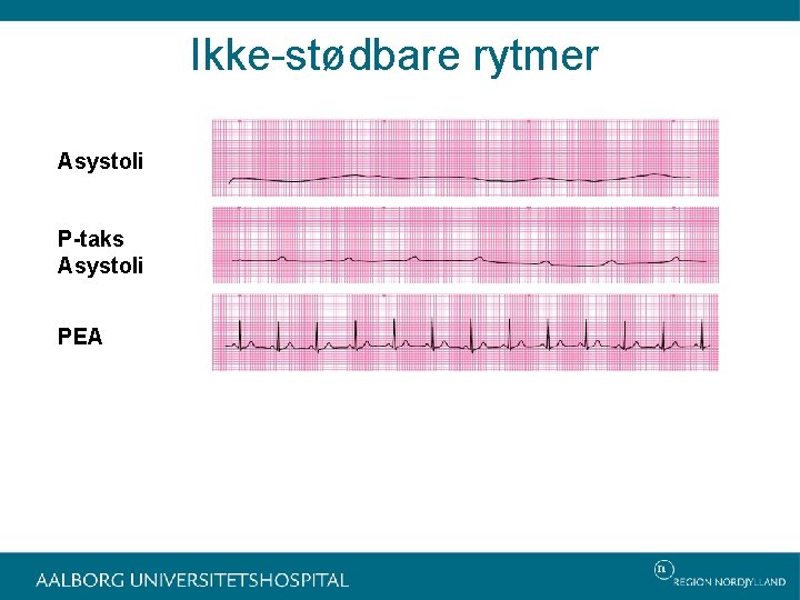 Ikke-stødbare rytmer Asystoli P-taks Asystoli PEA 