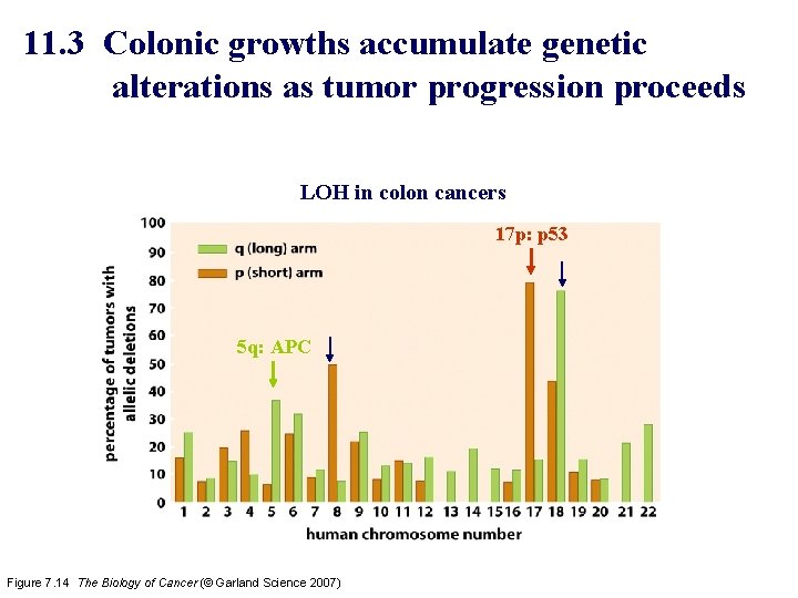 11. 3 Colonic growths accumulate genetic alterations as tumor progression proceeds LOH in colon