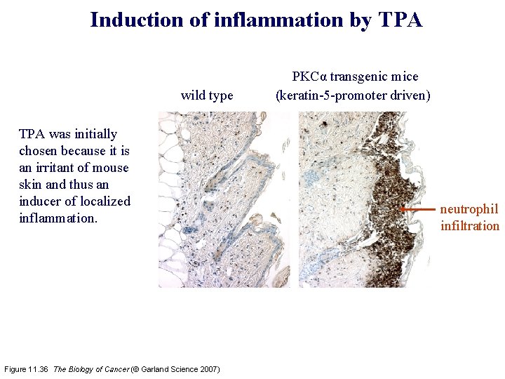 Induction of inflammation by TPA wild type TPA was initially chosen because it is