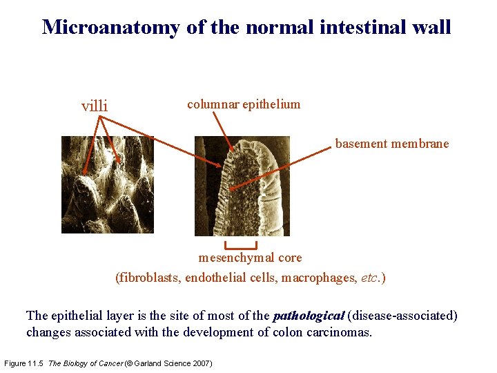 Microanatomy of the normal intestinal wall villi columnar epithelium basement membrane mesenchymal core (fibroblasts,