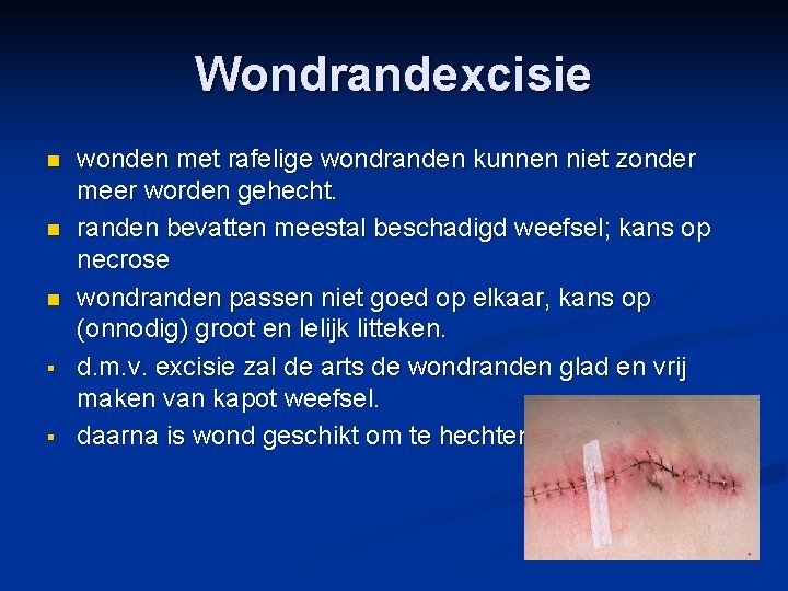 Wondrandexcisie n n n § § wonden met rafelige wondranden kunnen niet zonder meer