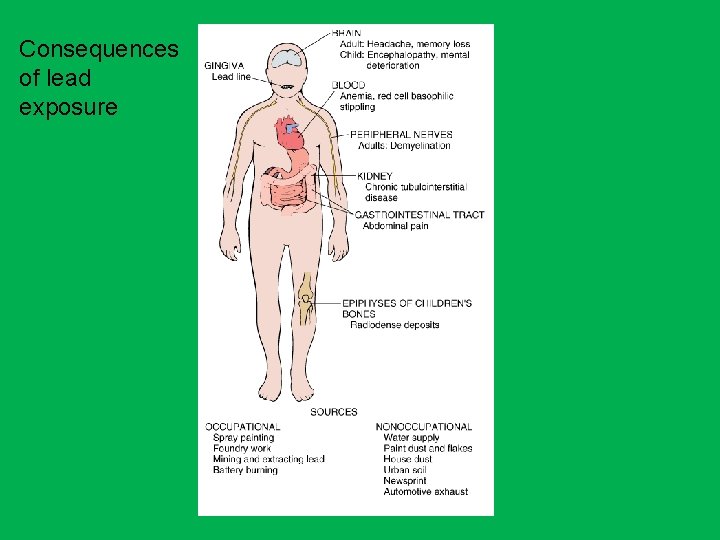 Consequences of lead exposure 