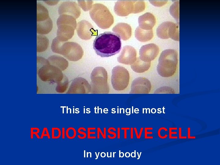 This is the single most RADIOSENSITIVE CELL In your body 