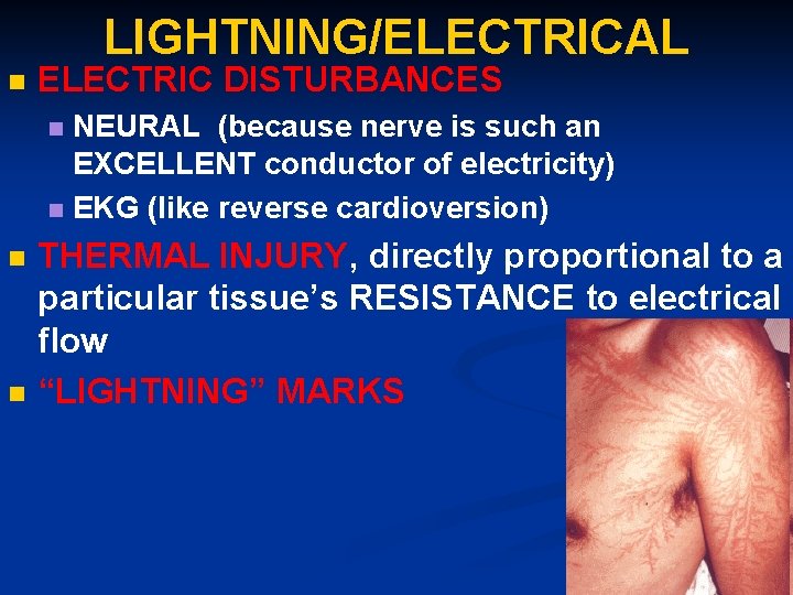 LIGHTNING/ELECTRICAL n ELECTRIC DISTURBANCES NEURAL (because nerve is such an EXCELLENT conductor of electricity)