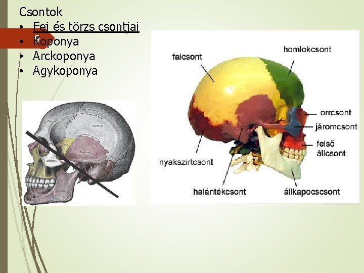 Csontok • Fej és törzs csontjai 9 • Koponya • Arckoponya • Agykoponya 