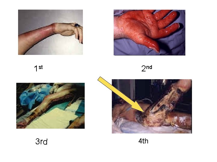 1 st 3 rd 2 nd 4 th 1 st 3 rd 2 nd 4 th