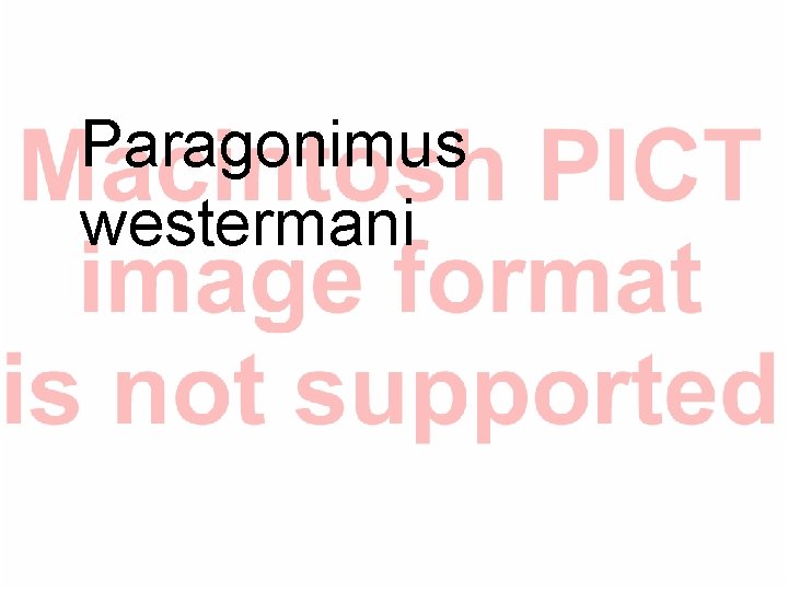 Paragonimus westermani Paragonimus westermani