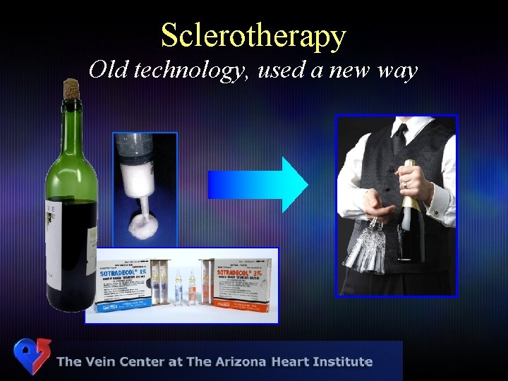 Sclerotherapy Old technology, used a new way 