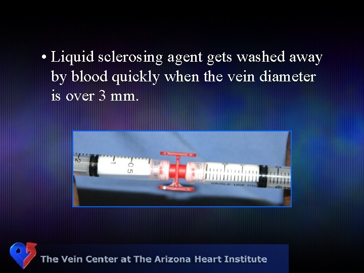  • Liquid sclerosing agent gets washed away by blood quickly when the vein