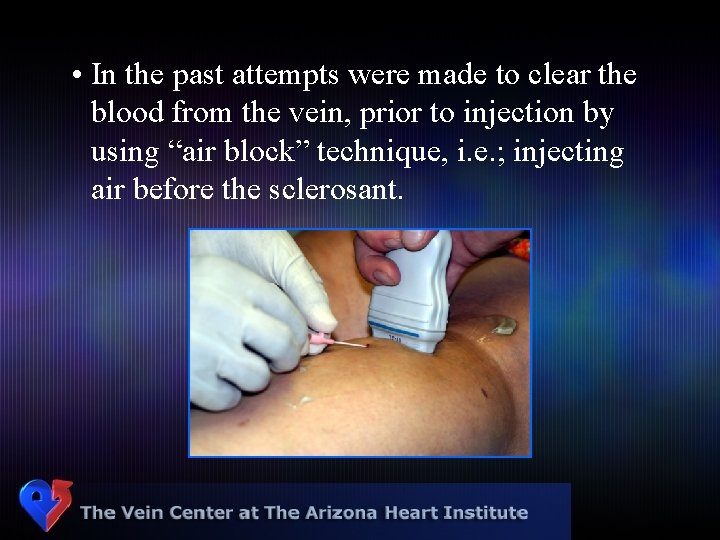  • In the past attempts were made to clear the blood from the