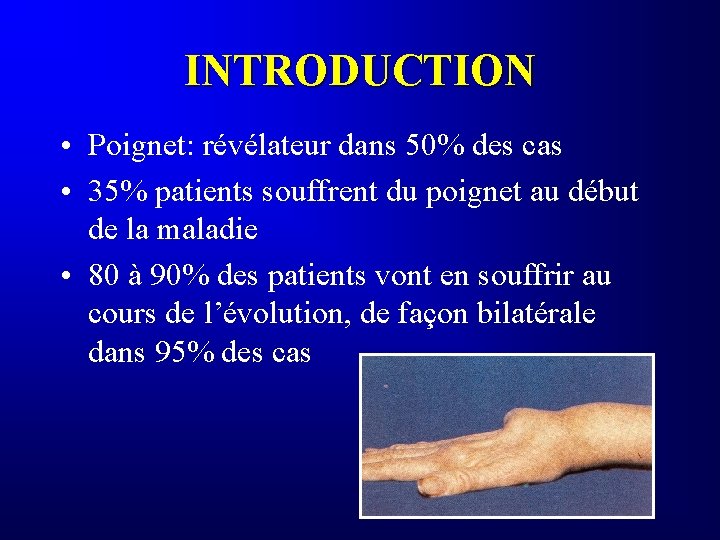 INTRODUCTION • Poignet: révélateur dans 50% des cas • 35% patients souffrent du poignet