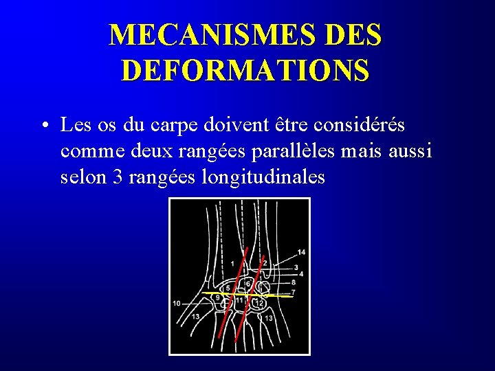 MECANISMES DEFORMATIONS • Les os du carpe doivent être considérés comme deux rangées parallèles