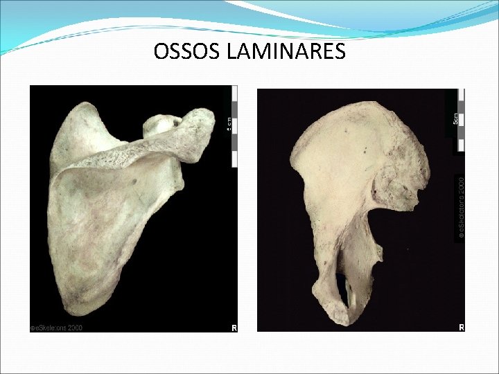 OSSOS LAMINARES OSSOS LAMINARES