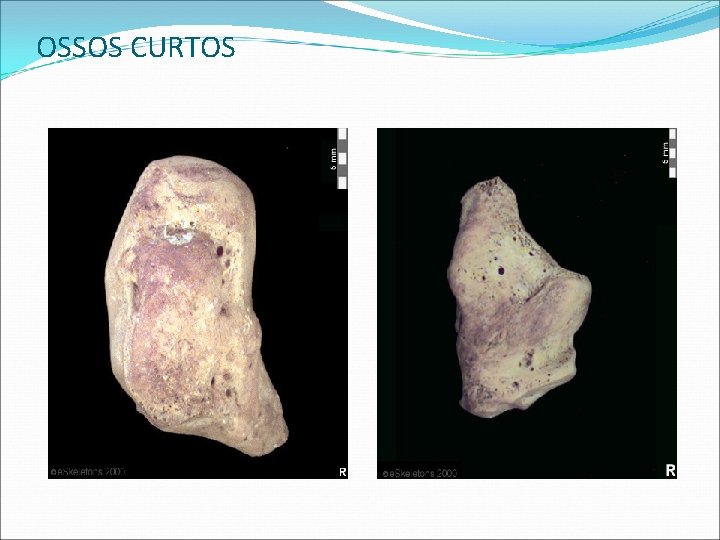 OSSOS CURTOS OSSOS CURTOS