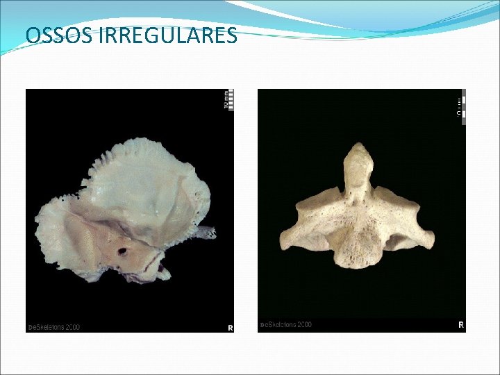 OSSOS IRREGULARES OSSOS IRREGULARES