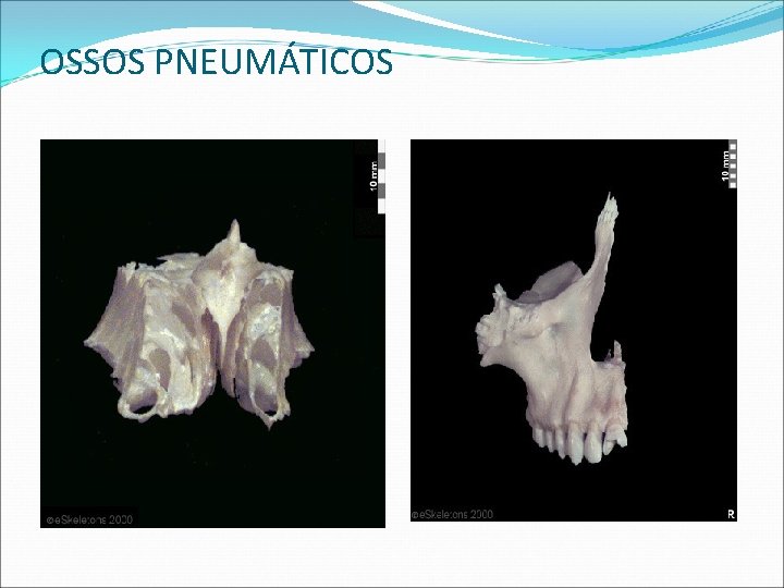 OSSOS PNEUMÁTICOS OSSOS PNEUMÁTICOS