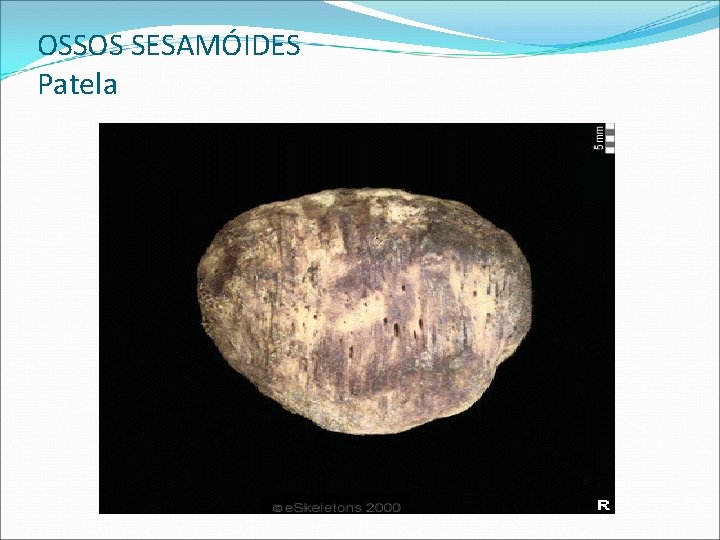 OSSOS SESAMÓIDES Patela OSSOS SESAMÓIDES Patela