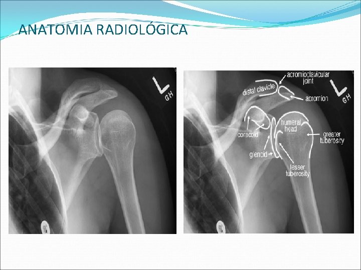 ANATOMIA RADIOLÓGICA ANATOMIA RADIOLÓGICA