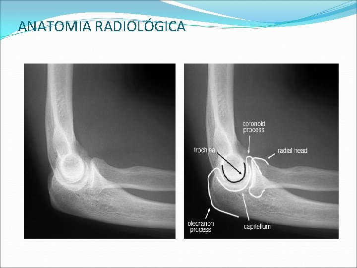 ANATOMIA RADIOLÓGICA ANATOMIA RADIOLÓGICA