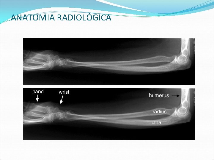 ANATOMIA RADIOLÓGICA ANATOMIA RADIOLÓGICA