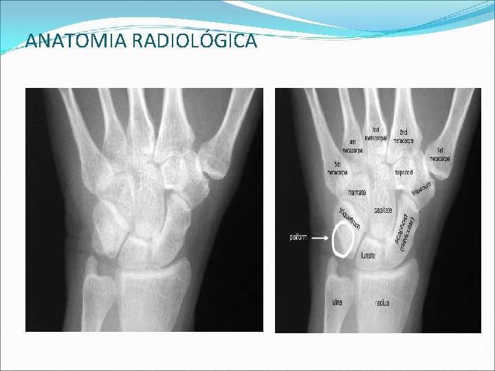 ANATOMIA RADIOLÓGICA ANATOMIA RADIOLÓGICA