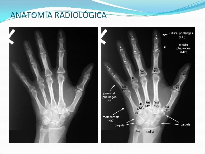 ANATOMIA RADIOLÓGICA ANATOMIA RADIOLÓGICA