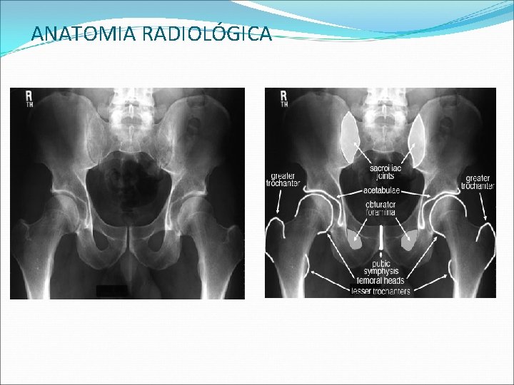 ANATOMIA RADIOLÓGICA ANATOMIA RADIOLÓGICA