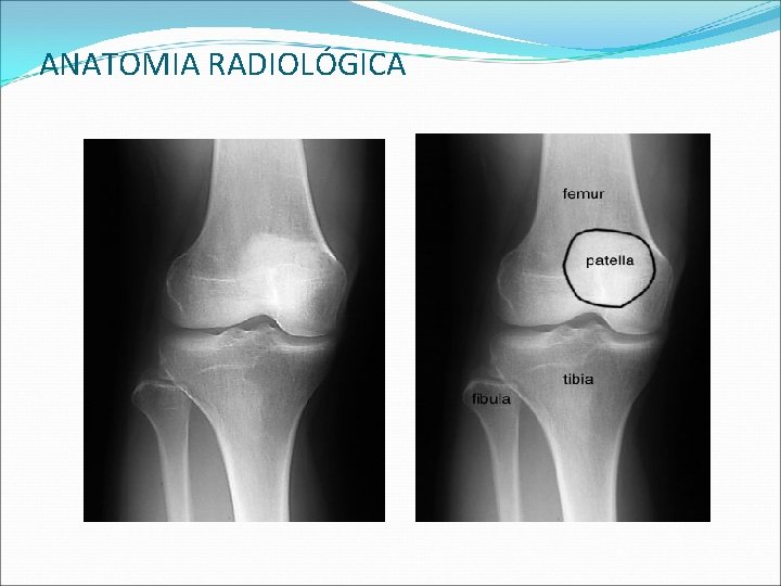 ANATOMIA RADIOLÓGICA ANATOMIA RADIOLÓGICA