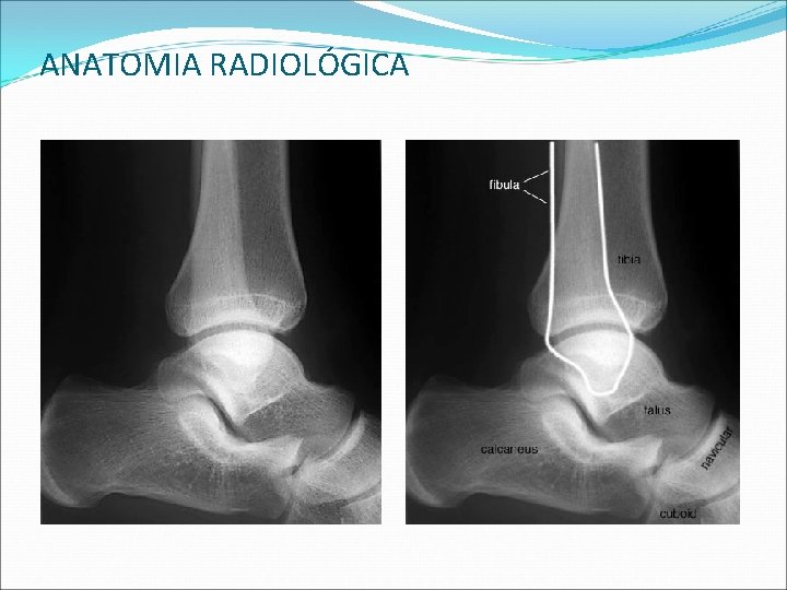 ANATOMIA RADIOLÓGICA ANATOMIA RADIOLÓGICA