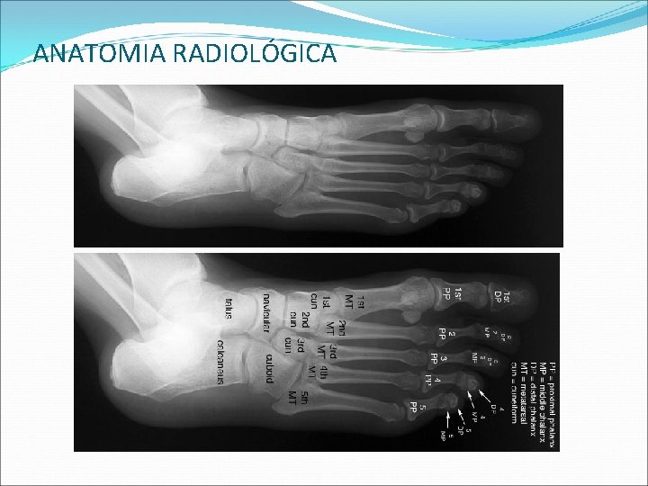 ANATOMIA RADIOLÓGICA ANATOMIA RADIOLÓGICA