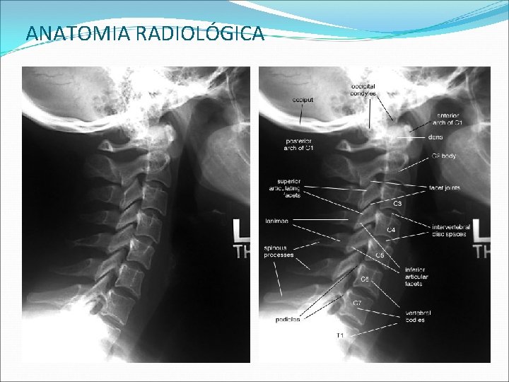 ANATOMIA RADIOLÓGICA ANATOMIA RADIOLÓGICA