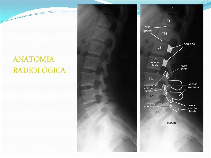 ANATOMIA RADIOLÓGICA ANATOMIA RADIOLÓGICA