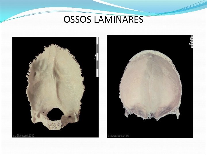 OSSOS LAMINARES OSSOS LAMINARES