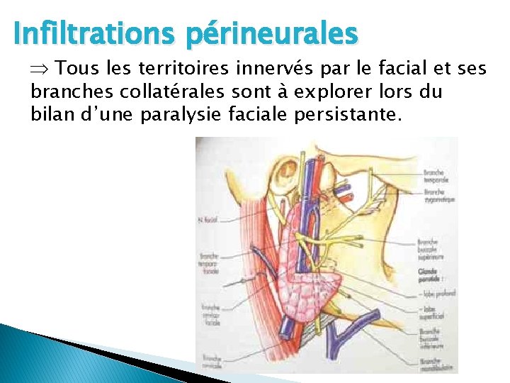 Infiltrations périneurales Tous les territoires innervés par le facial et ses branches collatérales sont