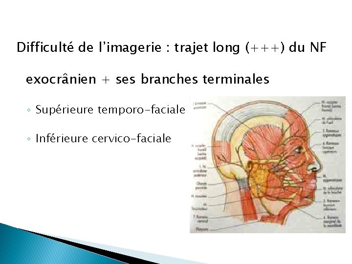 Difficulté de l’imagerie : trajet long (+++) du NF exocrânien + ses branches terminales